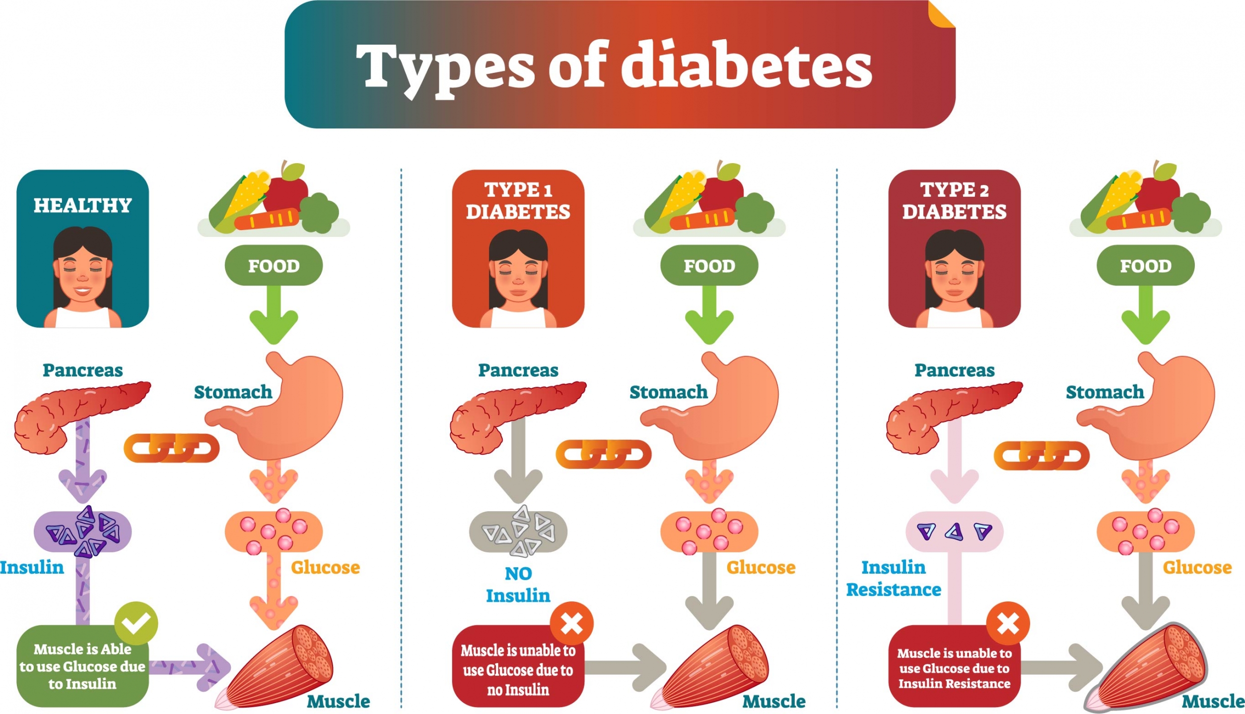 Types Of Diabetes Health And Human Services North Dakota   AdobeStock 203456324 %5BConverted%5D 